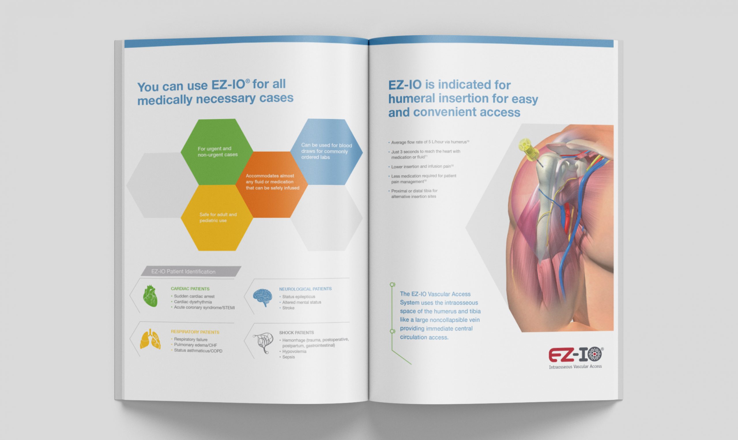 A two page spread about the benefits of EZ-IO